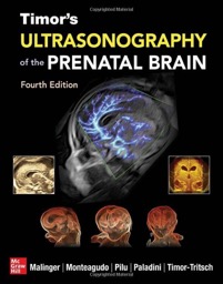 copertina di Timor ' s Ultrasonography of the Prenatal and Neonatal Brain