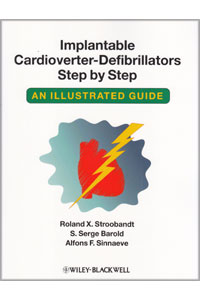 copertina di Implantable Cardioverter - Defibrillators Step by Step: An Illustrated Guide