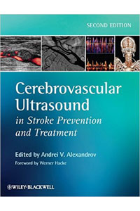 copertina di Cerebrovascular Ultrasound in Stroke Prevention and Treatment