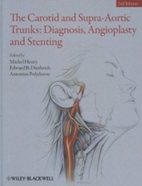 copertina di The Carotid and Supra - Aortic Trunks : Diagnosis, Angioplasty and Stenting