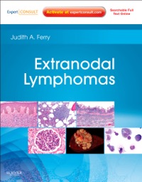copertina di Extranodal Lymphomas - Expert Consult - Online and Print