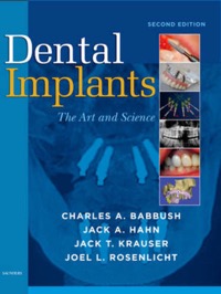 copertina di Dental Implants - The Art and Science