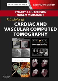 copertina di Principles of Cardiovascular Computed Tomography (CT) - Expert Consult - Online and ...