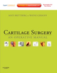 copertina di Cartilage Surgery - An Operative Manual, Expert Consult : Online and Print