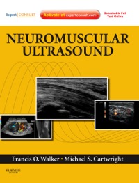 copertina di Neuromuscular Ultrasound - Expert Consult - Online and Print