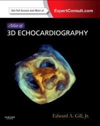 copertina di Atlas of 3D Echocardiography - Expert Consult – Online and Print
