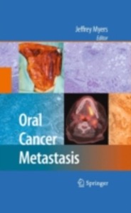copertina di Oral Cancer Metastasis