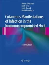 copertina di Cutaneous Manifestations of Infection in the Immunocompromised Host