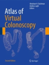 copertina di Atlas of Virtual Colonoscopy - on line access included
