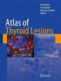 copertina di Atlas of Thyroid Lesions