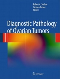 copertina di Diagnostic Pathology of Ovarian Tumors