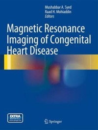 copertina di Magnetic Resonance Imaging ( MRI ) of Congenital Heart Disease