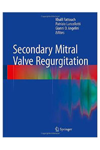 copertina di Secondary Mitral Valve Regurgitation