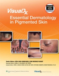 copertina di Essential Dermatology in Pigmented Skin Visualdx : The Modern Library of Visual Medicine