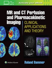 copertina di MR ( Magnetic Resonance ) and CT ( Computed Tomography ) Perfusion Imaging - Clinical ...
