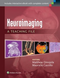 copertina di Neuroimaging: A Teaching File