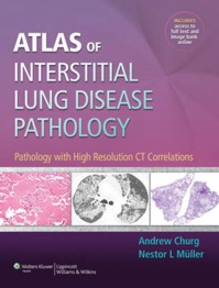 copertina di Atlas of Interstitial Lung Disease Pathology - Pathology with High Resolution CT ...