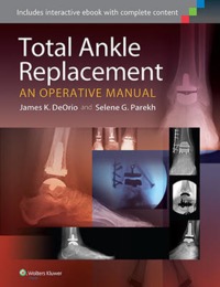 copertina di Total Ankle Replacement - An Operative Manual