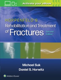 copertina di Hoppenfeld 's Treatment and Rehabilitation of Fractures
