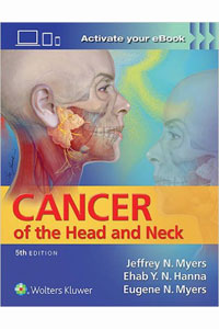copertina di Cancer of the Head and Neck
