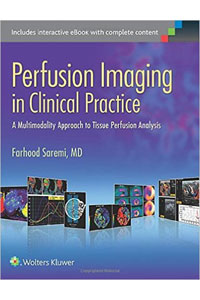 copertina di Perfusion Imaging in Clinical Practice: A Multimodality Approach to Tissue Perfusion ...
