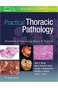 copertina di Practical Thoracic Pathology: Diseases of the Lung, Heart, and Thymus