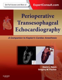 copertina di Perioperative Transesophageal Echocardiography - A Companion to Kaplan' s Cardiac ...