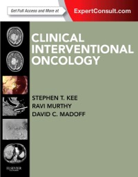 copertina di Clinical Interventional Oncology ( Expert Consult - Online and Print )