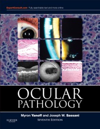 copertina di Ocular Pathology ( Expert Consult : Online and Print )