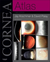 copertina di Cornea Atlas - Expert Consult - Online and Print