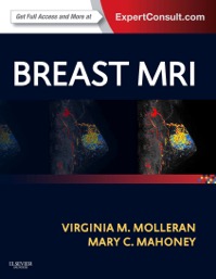 copertina di Breast MRI ( Magnetic Resonance Imaging ) -  Expert Consult: Online and Print 