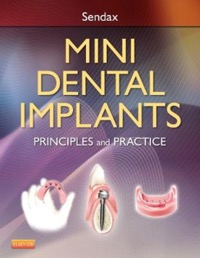 copertina di Mini Dental Implants - Principles and Practice