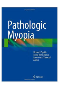 copertina di Pathologic Myopia