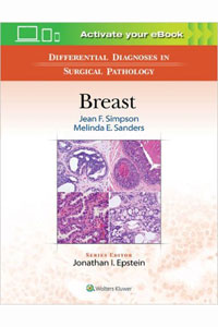 copertina di Differential Diagnoses in Surgical Pathology: Breast