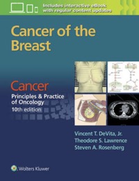 copertina di Cancer of the Breast: From Cancer: Principles and Practice of Oncology