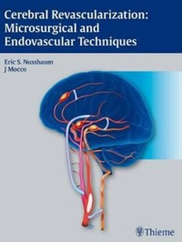 copertina di Cerebral Revascularization - Microsurgical and Endovascular Techniques