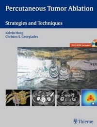 copertina di Percutaneous Tumor Ablation - Strategies and Techniques
