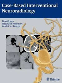 copertina di Case - Based Interventional Neuroradiology