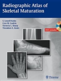 copertina di Radiographic Atlas of Skeletal Maturation - DVD included
