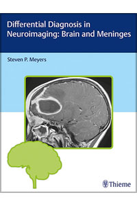 copertina di Differential Diagnosis in Neuroimaging - Brain and Meninges