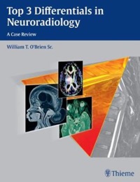 copertina di Top 3 Differentials in Neuroradiology - A case revew