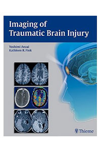 copertina di Imaging of Traumatic Brain Injury