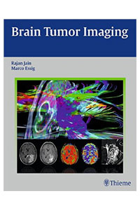 copertina di Brain Tumor Imaging