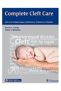 copertina di Complete Cleft Care - Cleft and Velopharyngeal Insuffiency Treatment in Children