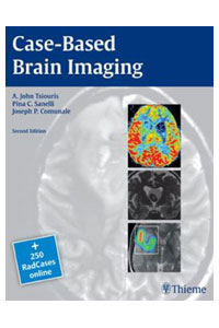 copertina di Case - Based Brain Imaging + 250 RadCases online