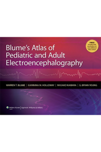 copertina di Blume' s Atlas of Pediatric and Adult EEGs