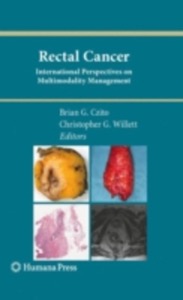 copertina di Rectal Cancer - International Perspectives on Multimodality Management