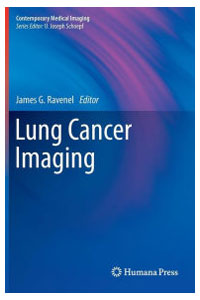 copertina di Lung Cancer Imaging