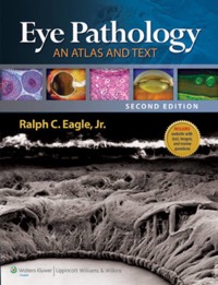 copertina di Eye Pathology : An Atlas and Text