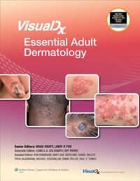 copertina di Visualdx:  Essential Adult Dermatology